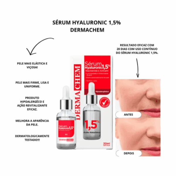 Sérum Facial Ácido Hialurônico Melhora Sinais Acne - Imagem 2