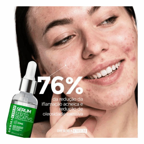 Sérum Peles Oleosas Acne e Cravos – Efeito Secativo Dermachem - Imagem 3