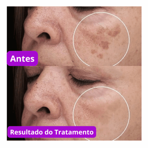 Sérum Facial Dermachem Bioretinol 30ml - Dia/Noite - Imagem 4