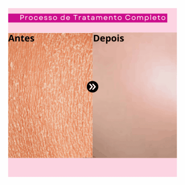 Sérum Facial Dermachem Bioretinol 30ml - Dia/Noite - Imagem 5